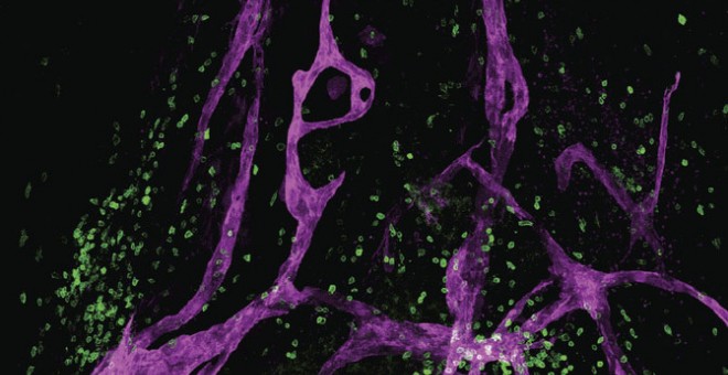 Para sorpresa de los científicos, se ha descubierto que el sistema linfático también actúa en el cerebro. / Jonathan Kipnis and Antoine Louveau