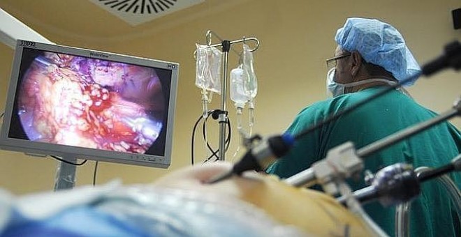 El diagnóstico precoz del cáncer de colon permite curarse al 90% de los pacientes,- EUROPA PRESS