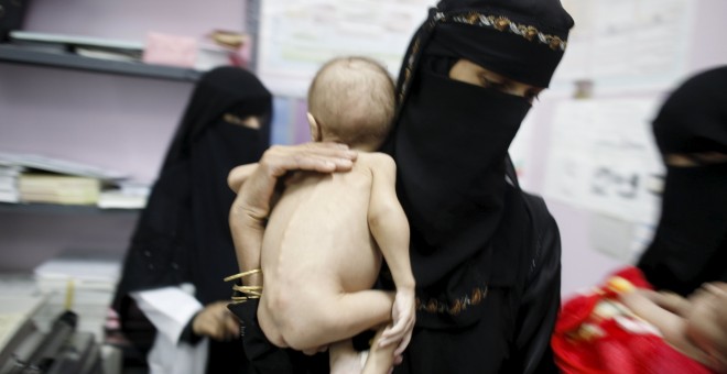 A woman holds her malnourished child at a malnutrition intensive care unit in Yemen's capital Sanaa April 6, 2016. REUTERS/Khaled Abdullah