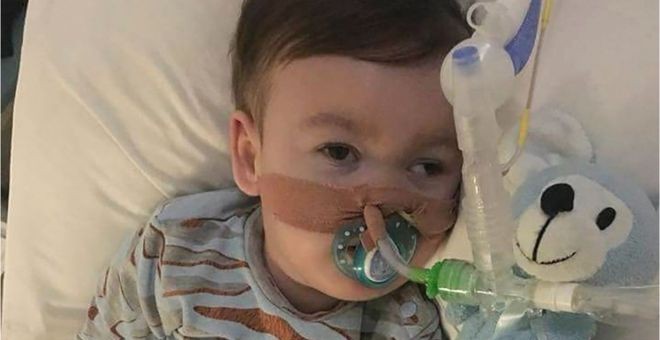 Imagen de Alfie Evans, antes de ser desconectado de su soporte vital. ACTION4ALFIE