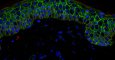 Corte de epidermis humana al microscopio (células en verde y sus núcleos en azul). EUROSTEMCELL