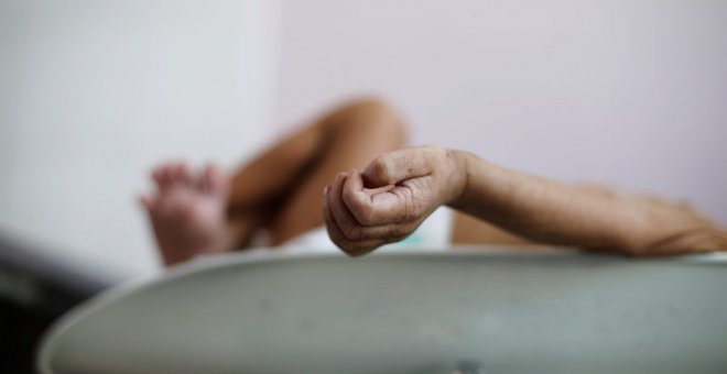 Los brazos de un niño yemení en estado de desnutrición en el hospital Al-Sabeen hospital in Saná. (REUTERS)