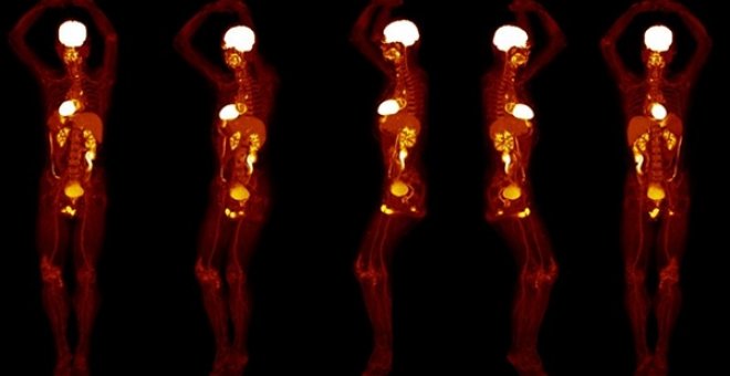 : Varias imágenes de un cuerpo humano completo obtenidas por el nuevo escáner Explorer./UCDAVIS/UNITED IMAGING