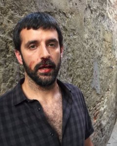 Jordi Borràs, después de la agresión. Imagen cedida por 'El Món'/QS