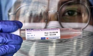 Un trabajador médico con una muestra de prueba del coronavirus (COVID-19). / EUROPA PRESS