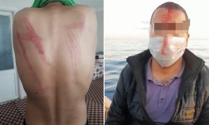 Izquierda: hematomas tras haber sido golpeado por las autoridades griegas durante la expulsión desde el campo de Diavata el 15-16 de abril.-BORDER VIOLENCE MONITORING NETWORK Derecha: hombre herido en la operación del 29 de mayo cerca de la isla de Lesbos