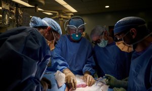 Fotografía de los investigadores estudiando el riñón de cerdo en la operación.