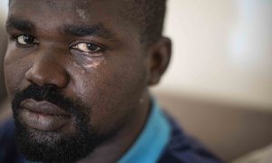 Nurdin Sanusi, refugiados sudanés devuelto en caliente cundo cruzó la valla de Melilla el pasado 24 de junio, muestra sus heridas en un lugar seguro en Casablanca, Marruecos.