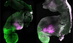 25/08/2022. Embriones naturales y sintéticos, uno al lado del otro, para mostrar la formación comparable del cerebro y el corazón.