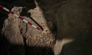 Un segundo cráneo con un puente de oro en la dentadura, aún por confirmar si es de unos de los fusilados en Colmenar Viejo en 1939.