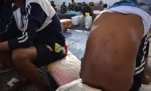 Una personas migrantes muestra signos de tortura en un centro de detención de Libia, en una imagen de 2019.