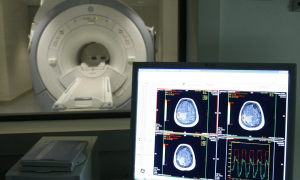 Vista d'un escàner a un centre de tractament d'Alzheimer, en una imatge d'arxiu