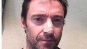 Hugh Jackman confiesa que tiene un cáncer de piel