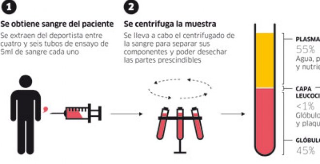 El PRP se pone de moda