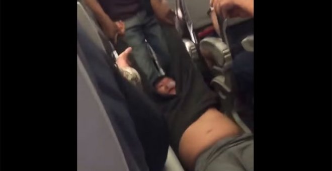 El pasajero expulsado a la fuerza del avión de United Airlines sufrió una conmoción, una rotura nasal y la pérdida de dos dientes