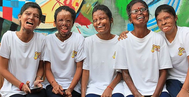 "El ácido nos ha arruinado la cara, pero no nuestra felicidad ni nuestros sueños"