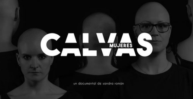 Mujeres calvas