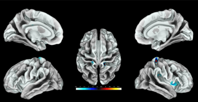 Así responde el cerebro femenino a la estimulación genital