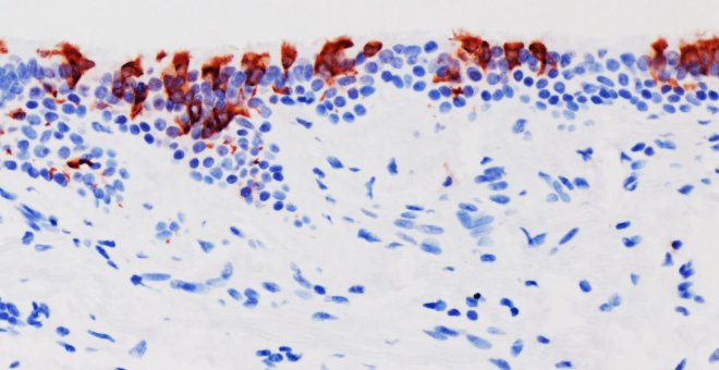 Principia Marsupia - Los síntomas de ómicron se parecerían más a los de la gripe que otras variantes