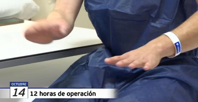 Daniel ya tiene tres dedos de sus pies implantados en su mano