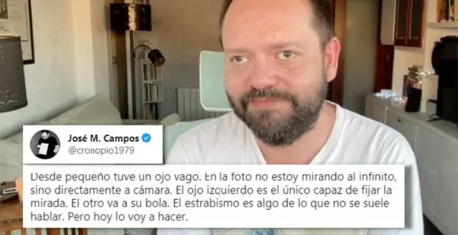 El hilo viral que visibiliza el estrabismo y hace un repaso de los famosos que lo padecen