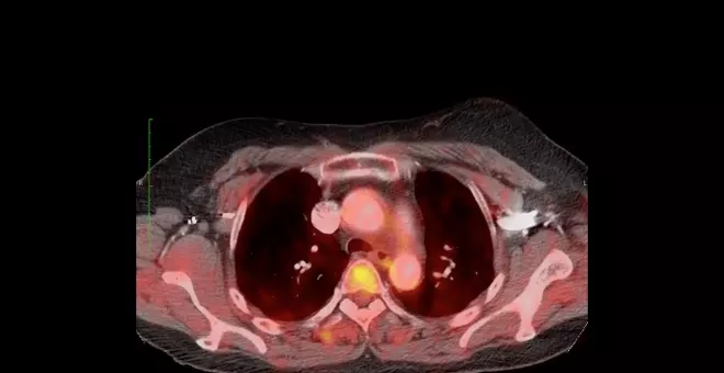 CNIO: viaje microscópico buscando la esperanza contra el cáncer